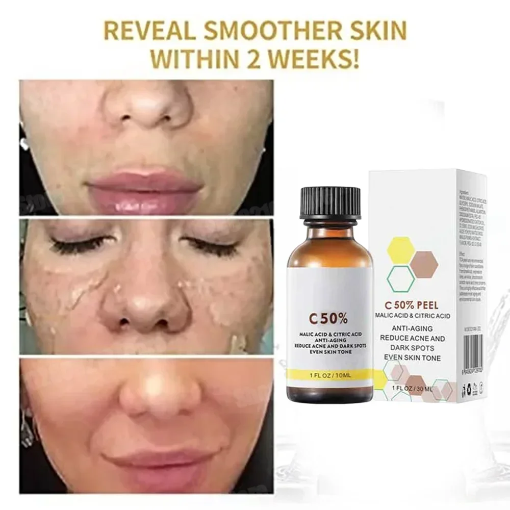 Skincare Salicylic Acid - Asam Salisilat Wajah Penetral Pengelupasan Wajah