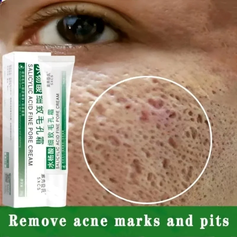 Skincare Salicylic Acid - Krim Pembersih Pori Asam Salisilat Mengecilkan