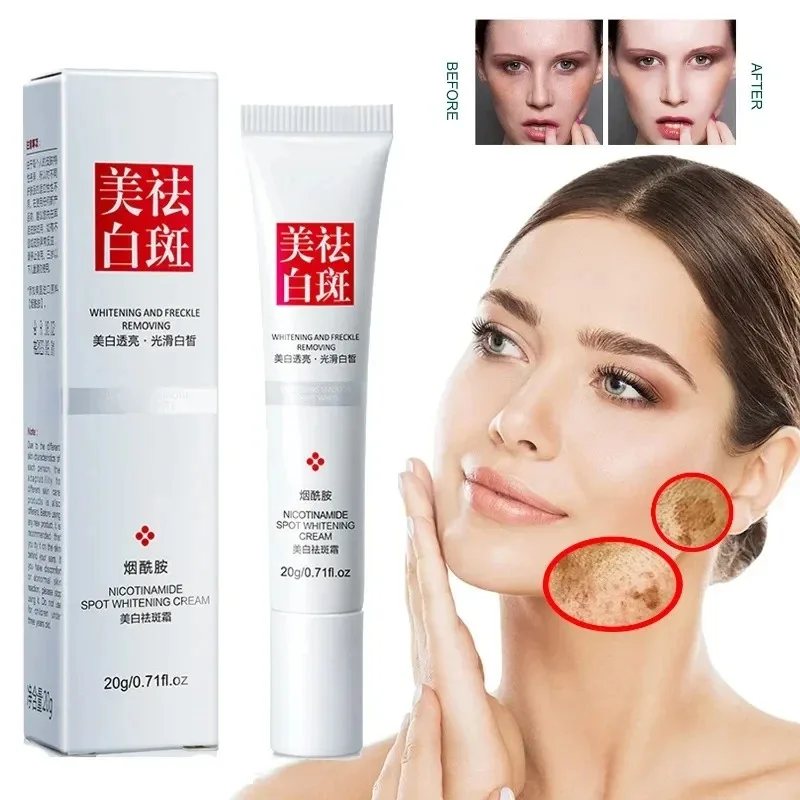 Skincare Niacinamide - Krim Wajah penghilang noda hitam, Krim