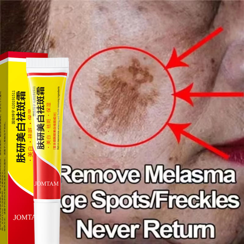 Skincare Niacinamide - Krim Pemutih Flek Hitam Krim Pencerah