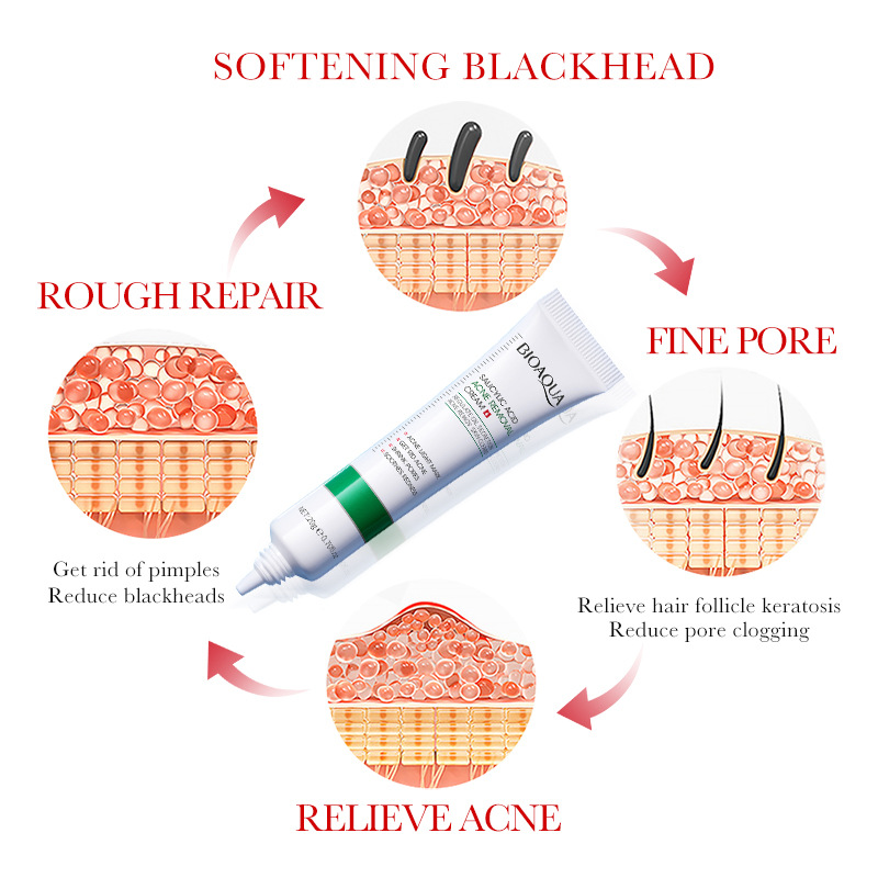 1/2/3 Buah BIOAQUA Krim Wajah  - Skincare Salicylic Acid ulasan dan harga