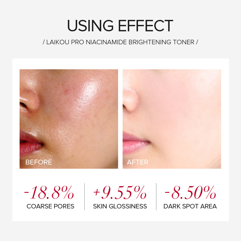 LAIKOU PRO Niacinamide 4Pcs Se - Skincare Niacinamide ulasan dan harga
