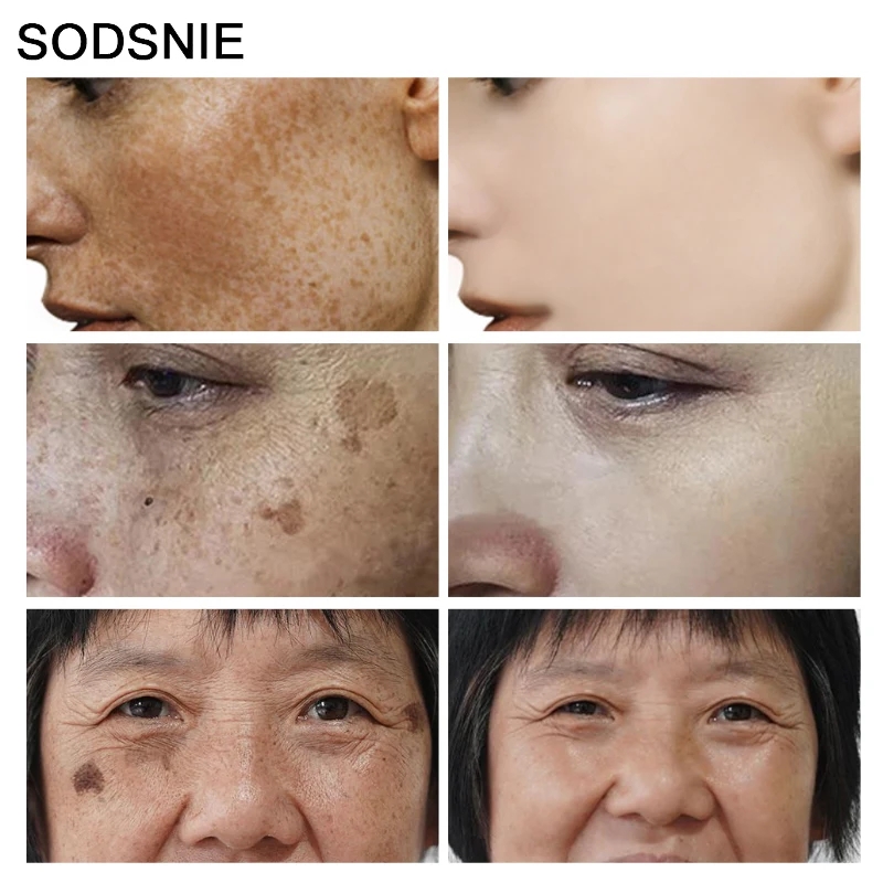 Penghilang noda hitam Vitamin  - Skincare Niacinamide ulasan dan harga