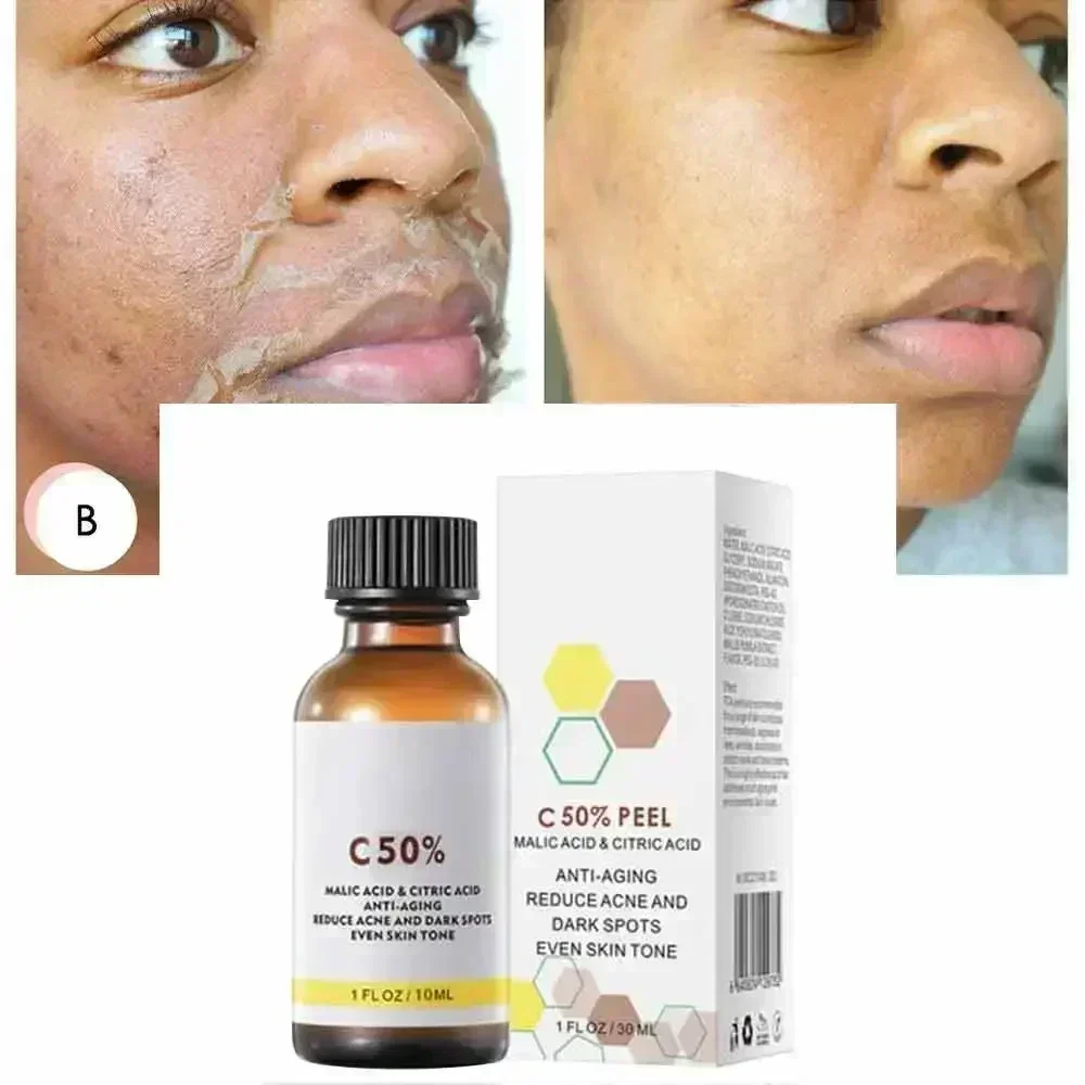 Asam Salisilat Wajah Penetral  - Skincare Salicylic Acid ulasan dan harga