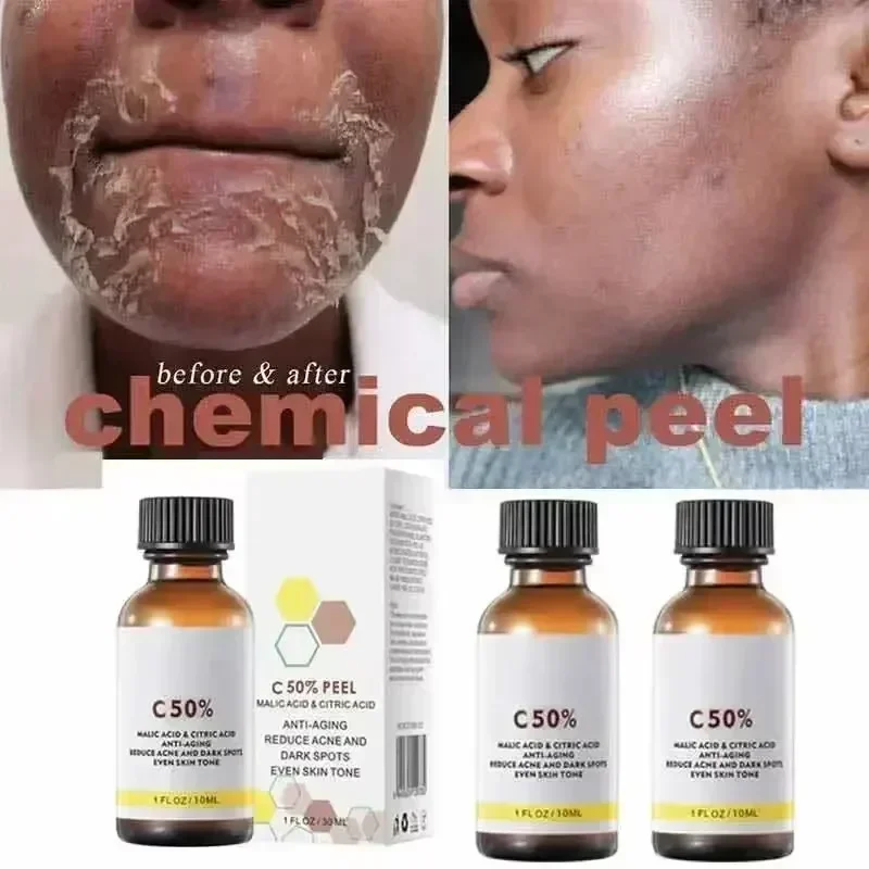 Asam Salisilat Wajah Penetral  - Skincare Salicylic Acid ulasan dan harga