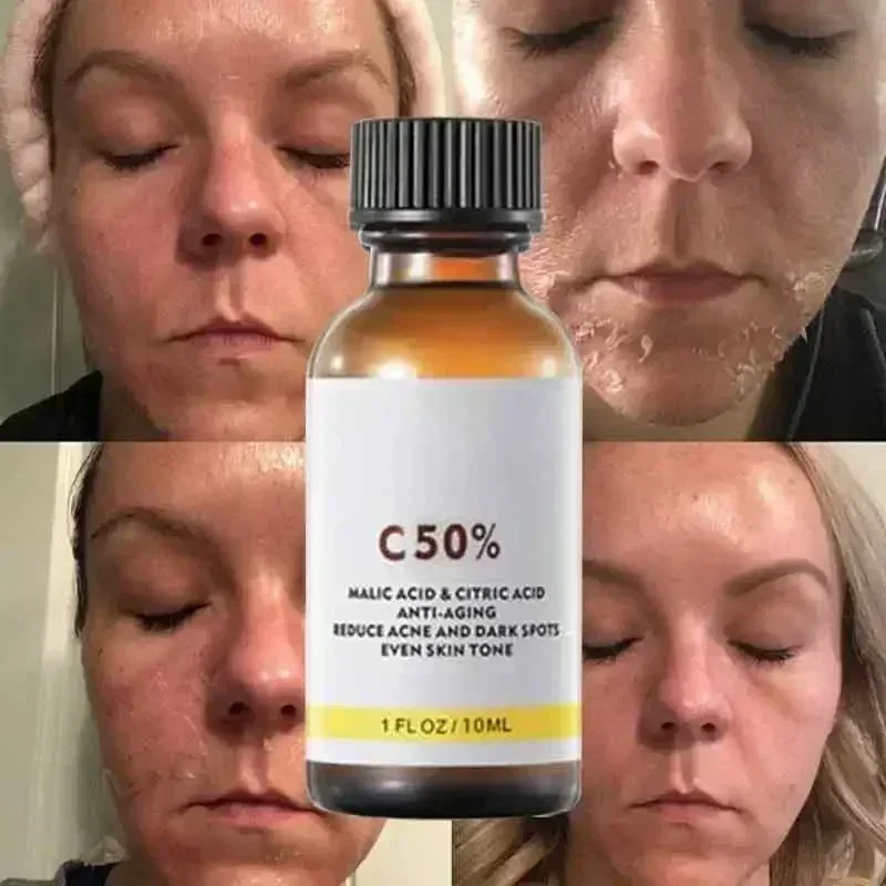 Asam Salisilat Wajah Penetral  - Skincare Salicylic Acid ulasan dan harga