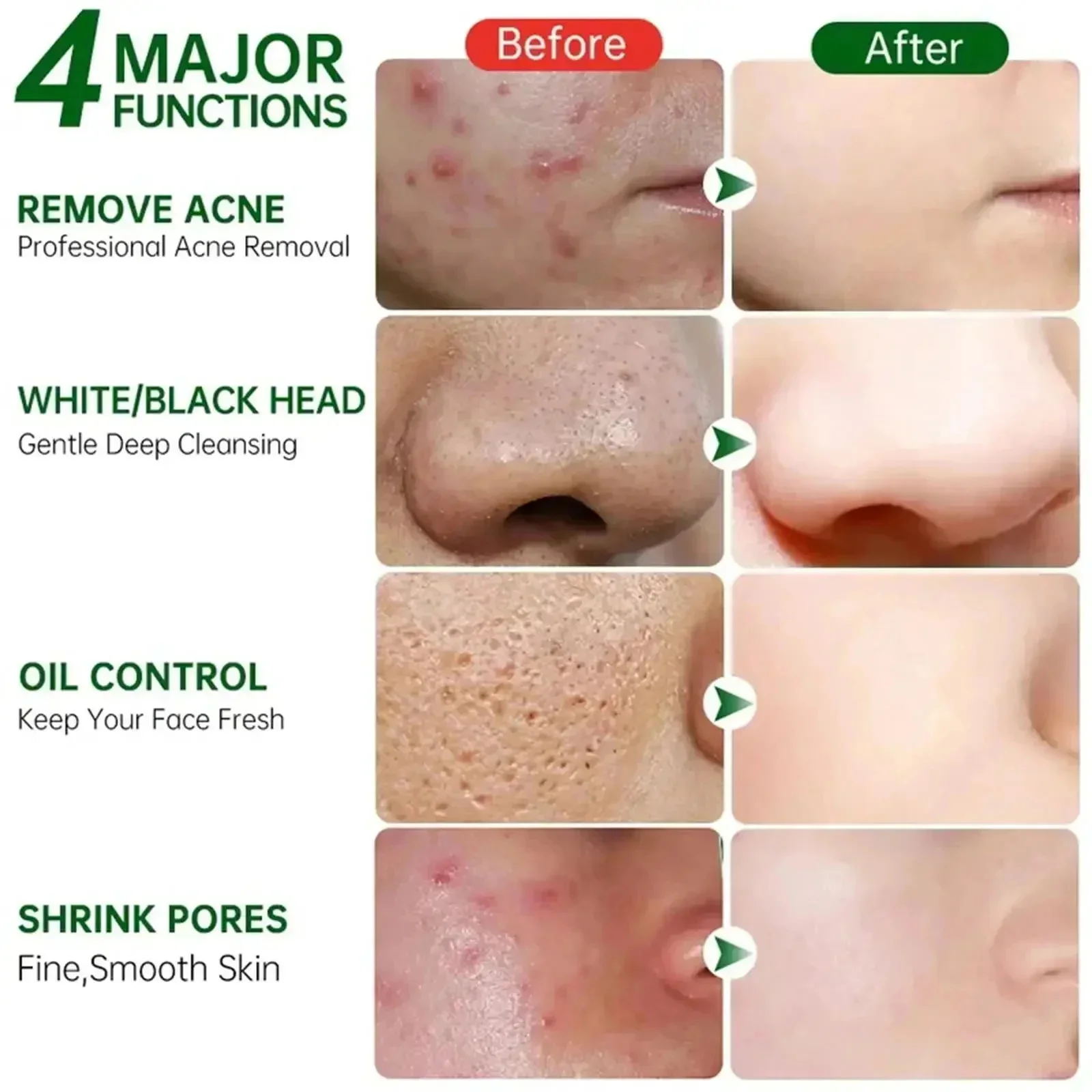 Krim Pembersih Pori Asam Salis - Skincare Salicylic Acid ulasan dan harga