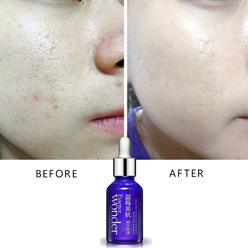 BIOAQUA Blueberry Serum Pengan - Skincare Garnier ulasan dan harga