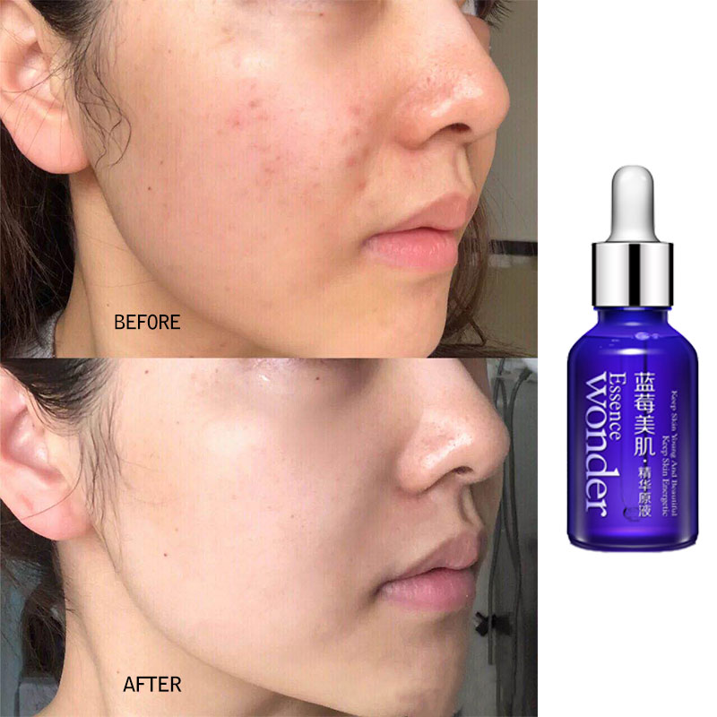 BIOAQUA Blueberry Serum Pengan - Skincare Garnier ulasan dan harga