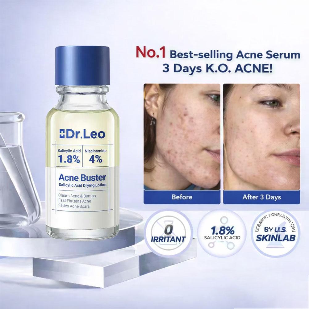 Lotion Perawatan Esens Asam Sa - Skincare Salicylic Acid ulasan dan harga
