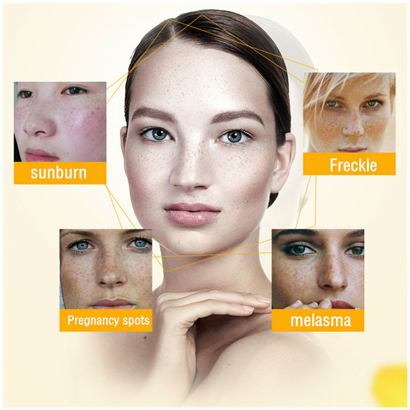 Dimollaure Krim Pemutih Bintik - Skincare Herbal ulasan dan harga