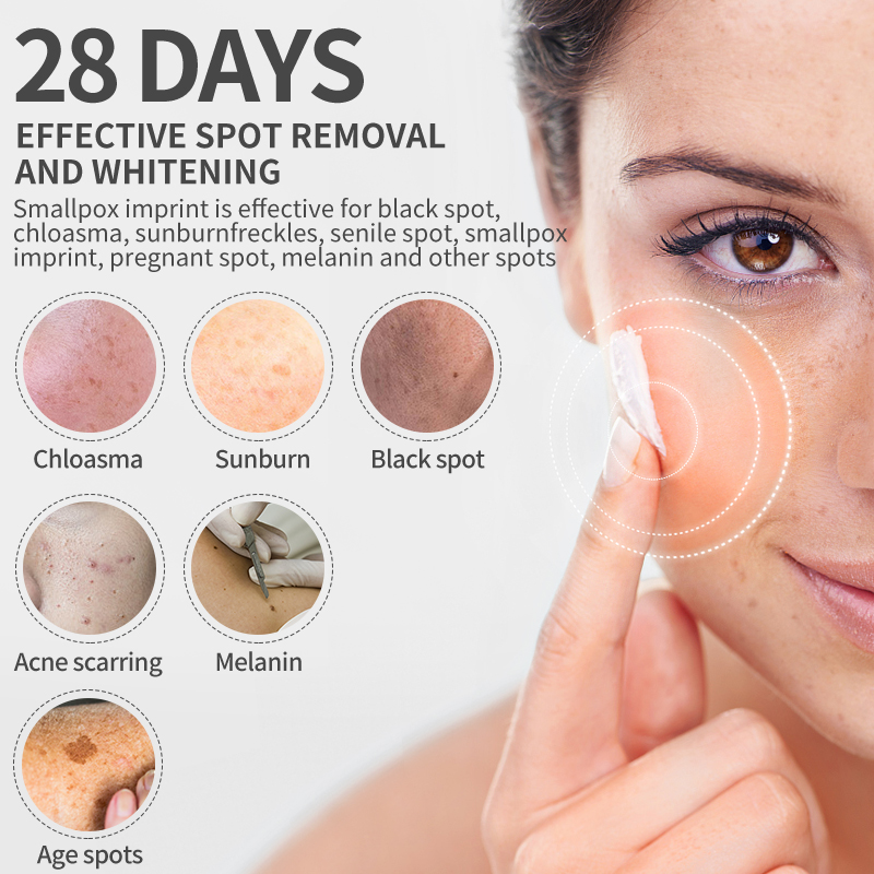 Dimollaure Krim Pemutih Bintik - Skincare Herbal ulasan dan harga