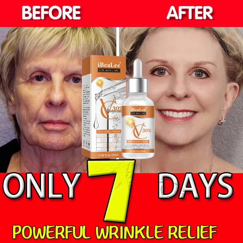 Serum Vitamin C Premium 30% Un - Skincare Garnier ulasan dan harga