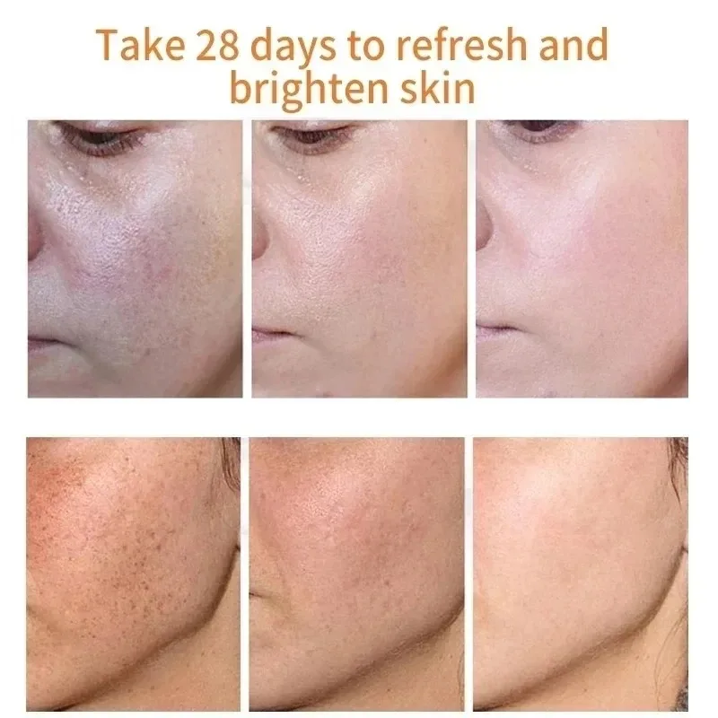 Krim Wajah penghilang noda hit - Skincare Niacinamide ulasan dan harga