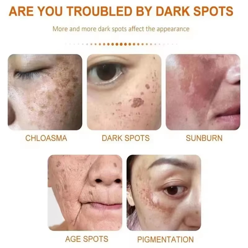 Krim Pemutih Flek Hitam Krim P - Skincare Niacinamide ulasan dan harga