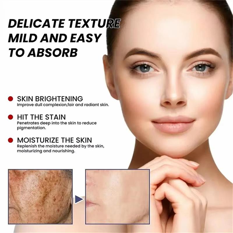 Krim Pemutih Flek Hitam Krim P - Skincare Niacinamide ulasan dan harga