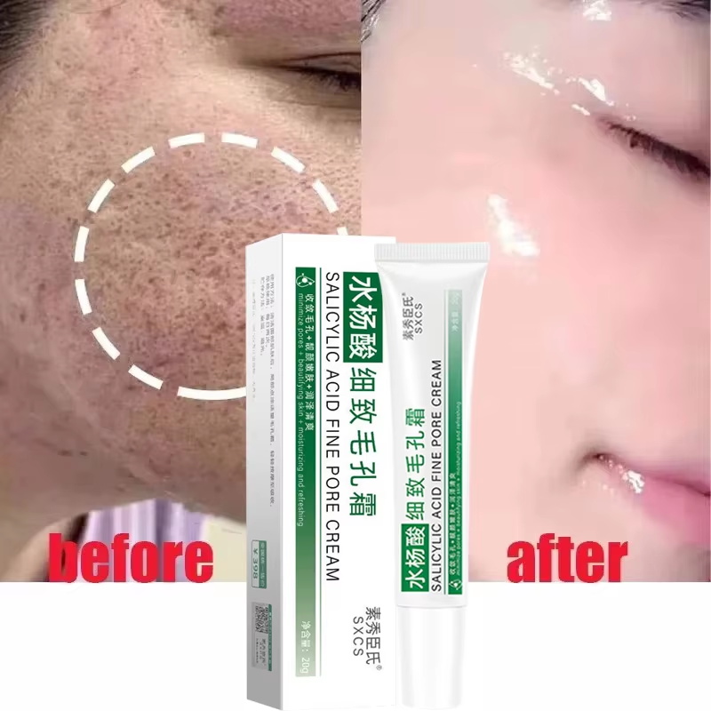 Krim Pengecil Pori Asam Salisi - Skincare Salicylic Acid ulasan dan harga
